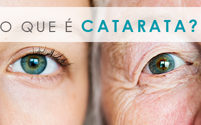 O que é Catarata - Dra Denise Leite Oftalmologista