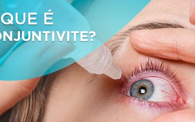 o que é conjuntivite dra denise leite oftalmologista