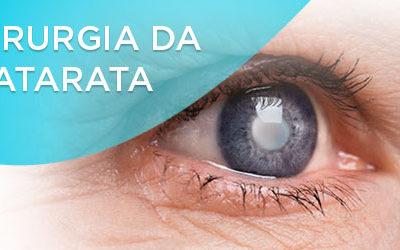 6 Mitos e Verdades sobre a Cirurgia da Catarata - dra denise leite oftalmologista