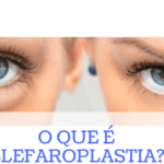 o que é blefaroplastia - dra denise leite oftalmo ribeirão preto sp