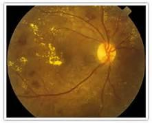 retinografia colorida - dra denise leite